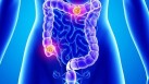 Colorectal cancer symptoms: What you need to know (Photo by Twitter/EvaSmartAI)