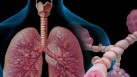 The study was done during the first wave of the pandemic in India on 207 Indians, and shows that the Indian subjects developed worse impairment in lung function compared to other published cohorts mostly with Caucasian subjects(Shutterstock)