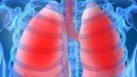 Beyond smoking: Understanding and treating Chronic Obstructive Pulmonary Disease (Photo by Shutterstock)