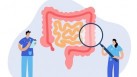A study says overall cases of colorectal cancer are falling, but could be rising in people under 50. (Twitter/CDC_Cancer)