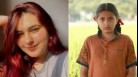 Dangal actor Suhani Bhatnagar dies at 19 due to Dermatomyositis: Causes, symptoms, all about rare inflammatory disease