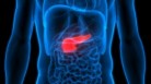 Gallbladder cancer: Stages, causes, risk factors, signs and symptoms, diagnosis, treatment, prevention tips