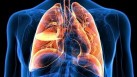 Genetic malfunction causes rare lung disease? Study finds defective cell function that was previously unknown