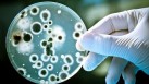 Gut microbiota influence severity of respiratory viral infection: Study