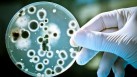 Gut microbiota influence severity of respiratory viral infection: Study(AFP/Istock)