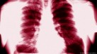 New insight into tuberculosis treatment: Research