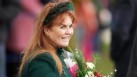 Signs and symptoms of malignant melanoma, the skin cancer Sarah Ferguson, Duchess of York is diagnosed with?
