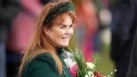 Sarah Ferguson, Duchess of York, in her recent Instagram post about her diagnosis, highlighted the importance of "checking the size, shape, colour and texture and emergence of new moles that can be a sign of melanoma" and urged everyone to be diligent.(AP)