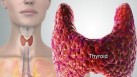 Thyroid troubles: The silent impact on your heart and what you need to know (Photo by Twitter/WebMD)