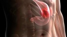 Urgent stomach cancer warning: Do not ignore these 5 common symptoms (Photo by Twitter/WebMD)