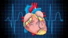 Dilated cardiomyopathy is a heart condition where the heart's main pumping chamber becomes enlarged and weakened(Freepik)