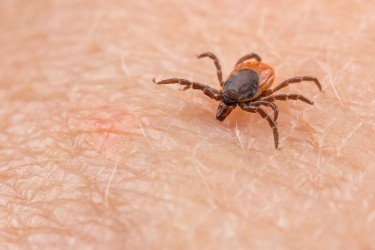 Tick on skin