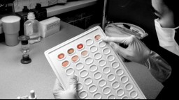 A lab technician looks at a blood test panel