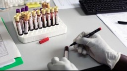 photo showing vials of blood samples and someone's gloved hands holding a pen