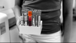 A person holding tubes of blood samples