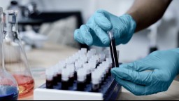 Vials of blood samples in a lab