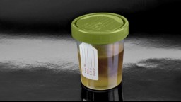 A cup with a urine sample