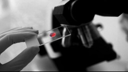 color pop photo showing drop of blood on microscope slide