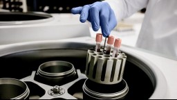 researcher's gloved hand reaching for blood sample vial