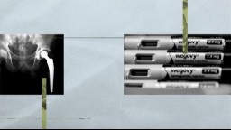 An illustration of a hip bone X-ray and 4 injections of semaglutide belonging to the Wegovy brand