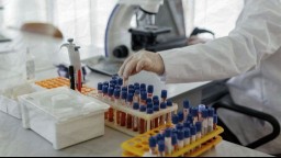 vials of blood samples in lab setting